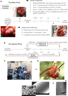 Dynamic Metabolic Changes During Prolonged Ex Situ Heart Perfusion Are Associated With Myocardial Functional Decline